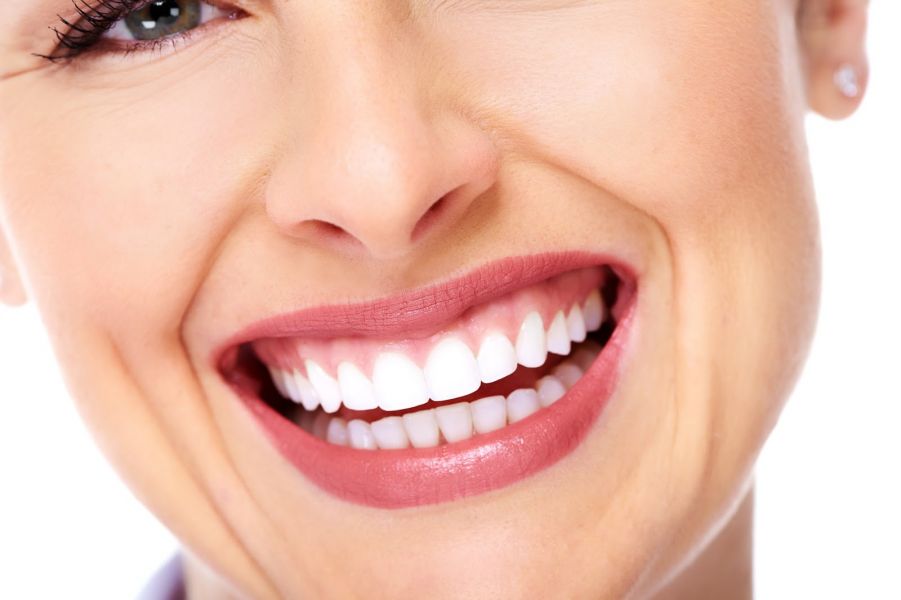 Lentes de contato dental Saiba como o sorriso perfeito é possível (3)